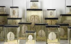 Colezione di cervelli Grant Museum of Zoology Londra